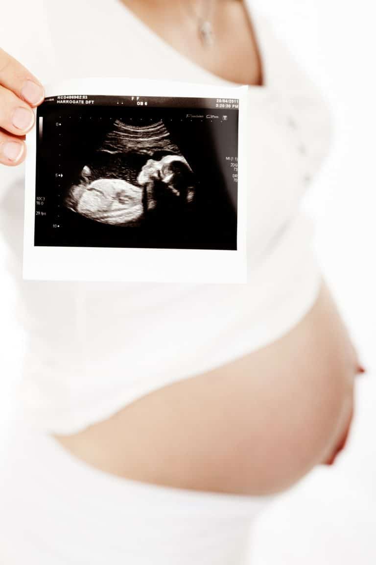 Ultrasound and Pregnant Woman